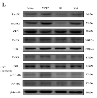IKK alpha/ beta Antibody - Fig.