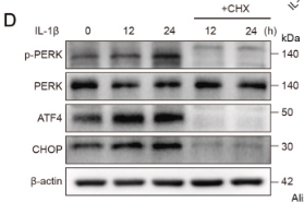 Phospho-PERK (Thr982) Antibody - Fig.