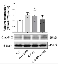 Claudin 2 Antibody - Figure 3 CWIR damaged intestinal epithelial tight junctions, which was improved by IL-6 KO.