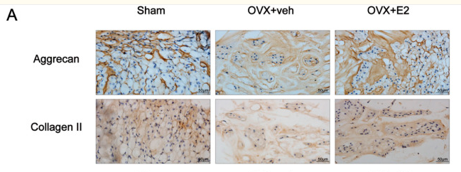 Aggrecan Antibody - FIGURE 2.