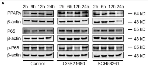 PPAR gamma Antibody - Figure 5 The expression of PPARγ, P65, and p-P65 was altered in macrophages cultured in low glucose and hypoxia.