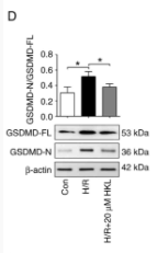 GSDMD N-Terminal Antibody(Mouse specific) - Figure 2 - HKL treatment notably inhibits pyroptosis in IEC-6 cells following H/R.