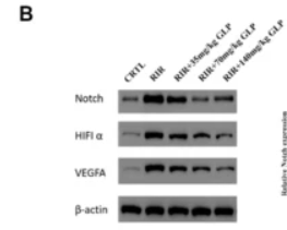 HIF1A Antibody - Fig.