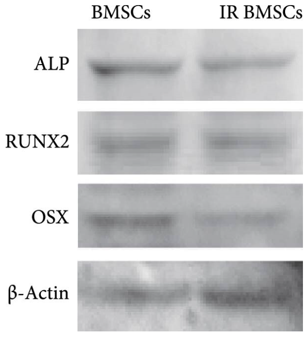 osterix Antibody - Figure 2 (e) Construction of IR BMSCs and validations for diminished osteogenic and migrative potential of IR BMSCs.