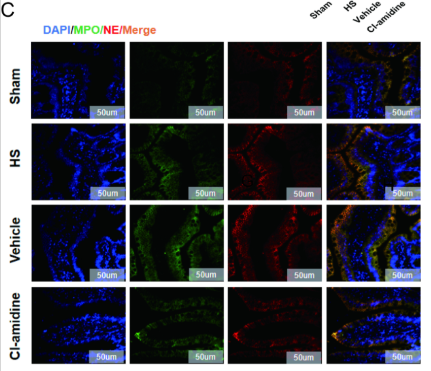 Neutrophil Elastase Antibody - Fig 4.
