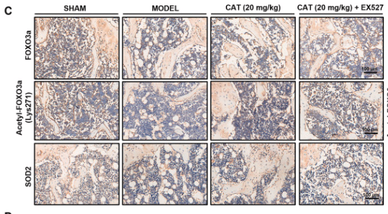 Acetyl-FOXO3A (Lys271) Antibody - Fig.
