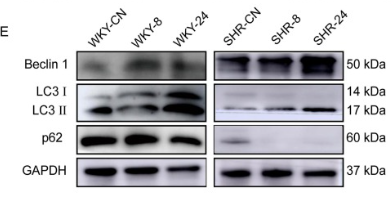 LC3A/B Antibody - Fig.