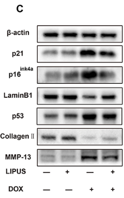 Collagen II Antibody - Figure 1 Low intensity pulsed ultrasound (LIPUS) directly inhibited the doxorubicin (DOX) induced chondrocyte senescence.