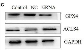 ACSL4/FACL4 Antibody - FIGURE 6 Effects of the ARNTL expression in AML cancer cell lines in vitro.