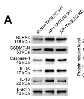 GSDMD N-Terminal Antibody(Mouse specific) - Fig 3.