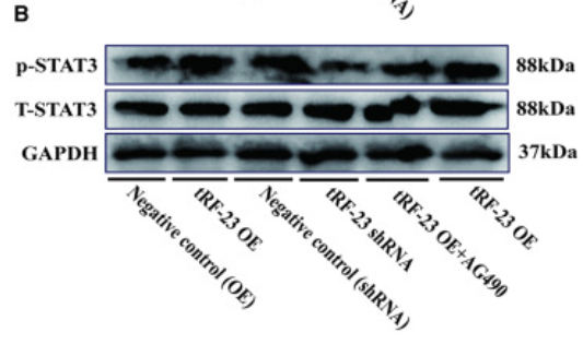 Phospho-STAT3 (Tyr705) Antibody - Figure 5 tRF-23 regulates the osteogenesis of hBMSCs by targeting SOCS1 and regulating JAK2/STAT3 activity (A and B) Overexpressing and knocking down tRF-23 respectively led to higher and lower levels of p-JAK2/STAT3.