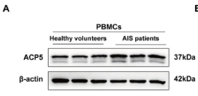ACP5 Antibody - Fig.