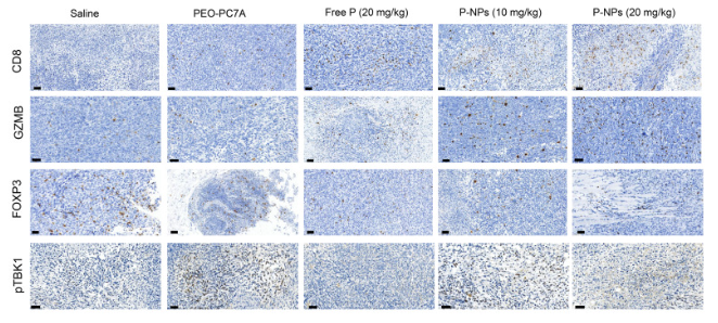 Phospho-TBK1 (Ser172) Antibody - Fig.