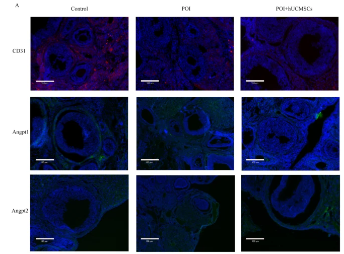 Angiopoietin 1 Antibody - Fig.