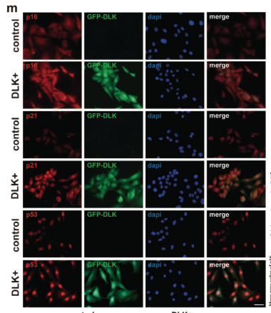 CDKN2A/p16INK4a Antibody - FIGURE 5 Autophagy was excessively activated, and hair cell senescence was aggravated by DLK overexpression.