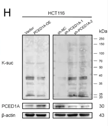 beta-Actin Antibody - Figure 9 Functional validation of PCED1A in CRC.