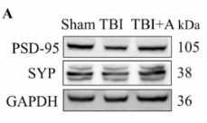 PSD95 Antibody - Fig.