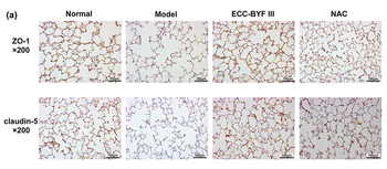 ZO 1 Antibody - Figure 5 ECC-BYF III improved the structural and functional damage of air-blood barrier through Nrf2 pathway.