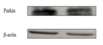 Parkin Antibody - Figure 3.