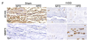 Aggrecan Antibody - FIGURE 1 Obesity increased the risk of IVDD (A) The impact of genetically correlated BMI and obesity-related traits on IVDD was assessed using scatter plot calculations employing methods such as Inverse Variance Weighting (IVW), MR-Egger, Simple Mode, Weighted Median, and Weighted Mode.