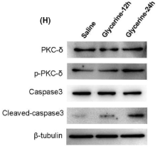 beta-Tubulin Antibody - FIGURE 1 Glycerine induced renal injury in a time-dependent manner.