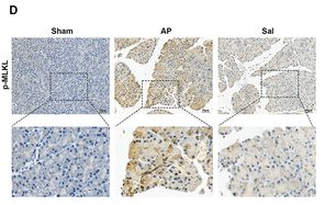 Phospho-MLKL (Ser358) Antibody - Figure 2 Sal inhibits the activation of the necroptosis pathway in pancreatic tissue.