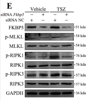Phospho-MLKL (Ser358) Antibody - FIGURE 8 FKBP5 mediates necroptosis-induced inflammatory signalling in human alveolar fibroblasts.