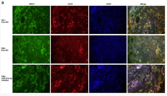 CD31 Antibody - FIGURE 5 Knockdown of miR-181b-5p in exosomes restored wound healing.