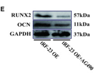 Osteocalcin Antibody - Figure 5 tRF-23 regulates the osteogenesis of hBMSCs by targeting SOCS1 and regulating JAK2/STAT3 activity (A and B) Overexpressing and knocking down tRF-23 respectively led to higher and lower levels of p-JAK2/STAT3.