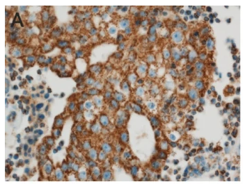 IL17A Antibody - Fig.