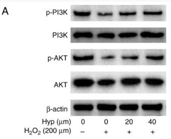 Phospho-AKT1 (Thr308) Antibody - Figure 6.