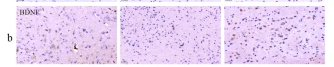 BDNF Antibody - Fig.