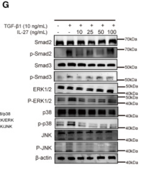 Phospho-p38 MAPK (Thr180/Tyr182) Antibody - Figure 4 IL-27 inhibited fibrosis progression through the MAPK pathway in TAO (A and B) IHC staining for fibrosis markers (n = 4).