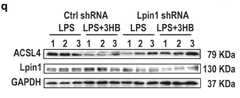 ACSL4/FACL4 Antibody - Figure 7.