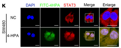 STAT3 Antibody - Figure 6 4-HPA promotes the transcription of CXCL3 regulated by STAT3 in CRC cells.