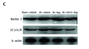 LC3A/B Antibody - Figure 5.
