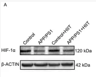 HIF1A Antibody - FIGURE 7 The effect of HIIT on the HIF-1α expression in APP/PS1 mice.