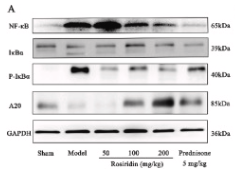 Phospho-IKB alpha (Ser32/Ser36) Antibody - Fig.