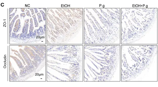 ZO 1 Antibody - Figure 4 Damage to the intestinal tissue caused by P.