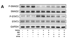 Phospho-STAT3 (Tyr705) Antibody - Figure 9 Effect of QBY on STAT3 and SMAD2 phosphorylation via the S1P/S1PR1 pathway.