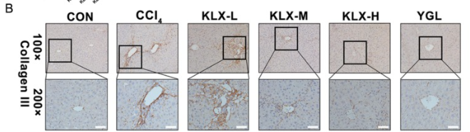 Collagen III Antibody - Fig.