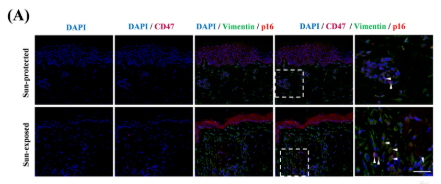 CDKN2A/p16INK4a Antibody - FIGURE 4 Increased number of CD47+ senescent fibroblasts and SIRPα+ macrophages in the sun-exposed aged skin.