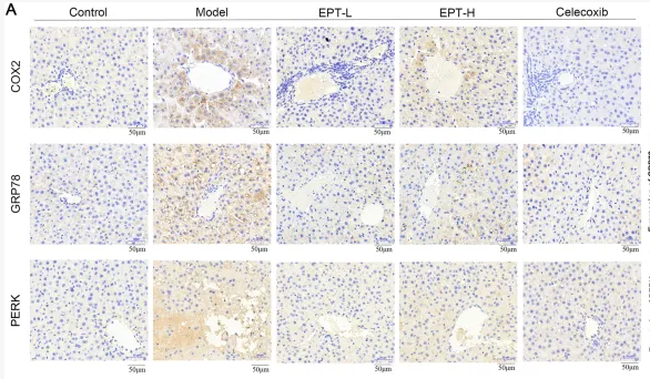 Cox2 Antibody - FIGURE 5 Detection of COX2, GRP78, and PERK expression in rat liver tissue by immunohistochemical staining.