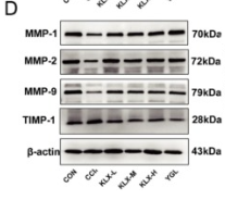 MMP2 Antibody - Fig.