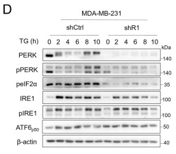 IRE1 Antibody - Figure 1 .