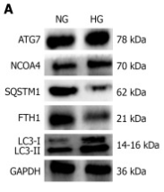 ATG7 Antibody - Figure 10.