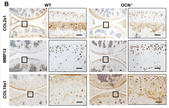 COL10A1 Antibody - Figure 1.