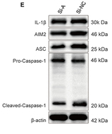 Cleaved-Caspase 1 (Asp296), p20 Antibody - Figure 3 Effects of AIM2 Overexpression and Knockdown on IL-1β, ASC, and Caspase-1 Expression in Gingival Fibroblasts This figure demonstrates the regulatory role of AIM2 in the expression of key inflammatory mediators.