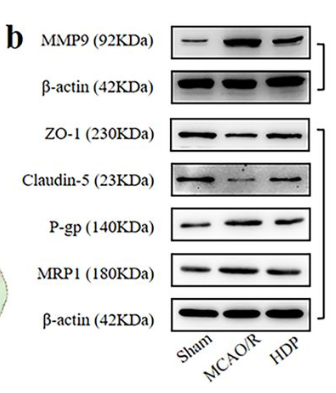 MMP9 Antibody - Figure 4 Close✕ Effect of HDP −20° immediately after reperfusion with 1 hour on BBB and cerebral oedema in MCAO/R.