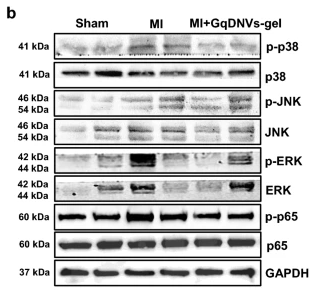Phospho-ERK1/2 (Thr202/Tyr204) Antibody - Fig.